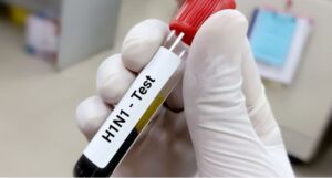 स्वाइन फ्लू के 3 नवा मरीज मिलिन, 7 मरीज के इलाज जारी